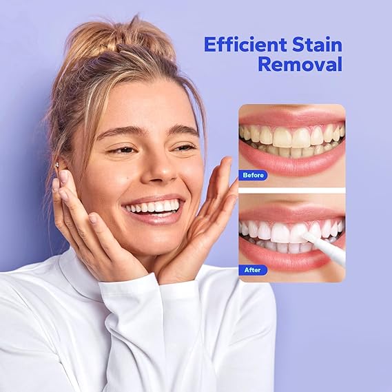 Teeth Whitening Pen (4 Count), No Sensitivity Teeth Whitening Gel, Effective Teeth Whitener, Travel-Friendly Tooth Whitening Pen, Carbamide Peroxide Tooth Bleaching Gel for Adults